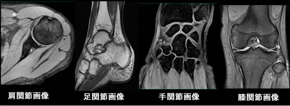 整形領域・肩関節/膝関節/手関節