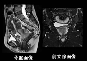 骨盤領域