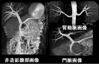 腹部領域